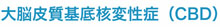 大脳皮質基底核変性症